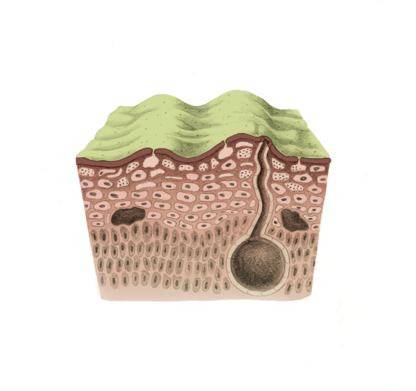 Chitrid Fungus Stage 2